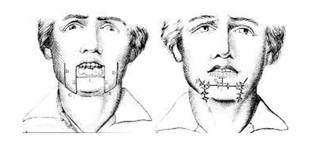 Docteur Nicolas VIDAL. Chirurgie maxillofaciale et esthétique du visage à la Réunion 974. Les lésions de la lèvre.
